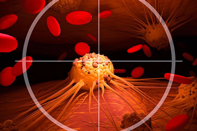 Канцерофобия – крайность, мешающая нормальной жизни, или фобия, которая позволит вовремя диагностировать рак?