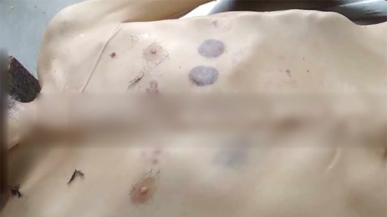 Смерть от голода в Нагорном Карабахе – следствие фашистской политики Азербайджана, и начало нового геноцида